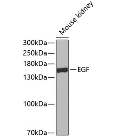 EGF Rabbit Polyclonal Antibody