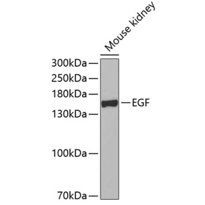 EGF Rabbit Polyclonal Antibody