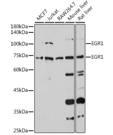 EGR1 Rabbit Polyclonal Antibody
