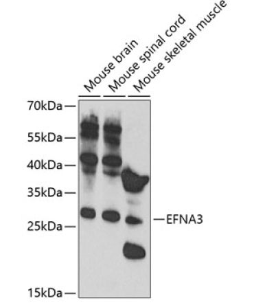 EFNA3 Rabbit Polyclonal Antibody