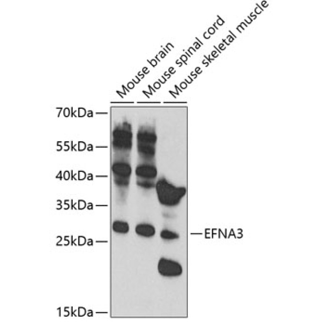 EFNA3 Rabbit Polyclonal Antibody