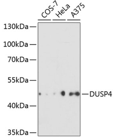 DUSP4 Rabbit Polyclonal Antibody
