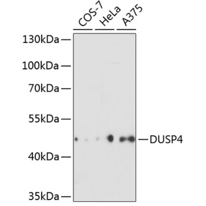 DUSP4 Rabbit Polyclonal Antibody