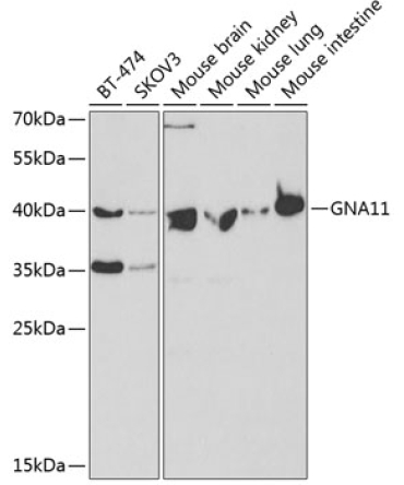 GNA11 Rabbit Polyclonal Antibody