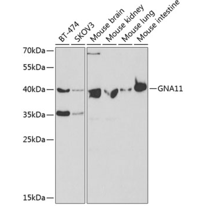 GNA11 Rabbit Polyclonal Antibody