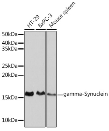 gamma-Synuclein Rabbit Monoclonal Antibody