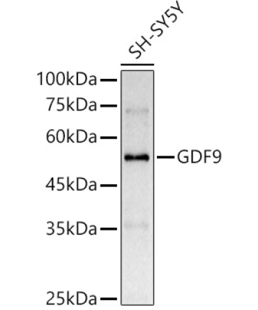 GDF9 Rabbit Polyclonal Antibody