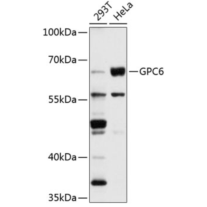GPC6 Rabbit Polyclonal Antibody