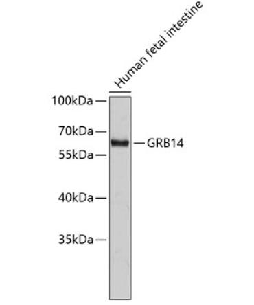 GRB14 Rabbit Polyclonal Antibody