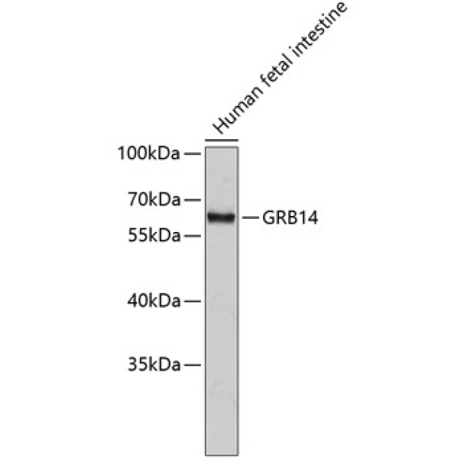 GRB14 Rabbit Polyclonal Antibody