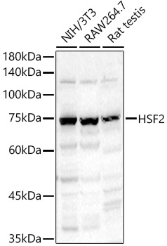 HSF2 Rabbit Polyclonal Antibody