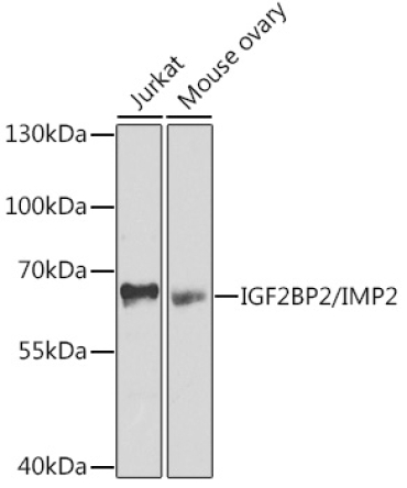 IGF2BP2/IMP2 Rabbit Polyclonal Antibody