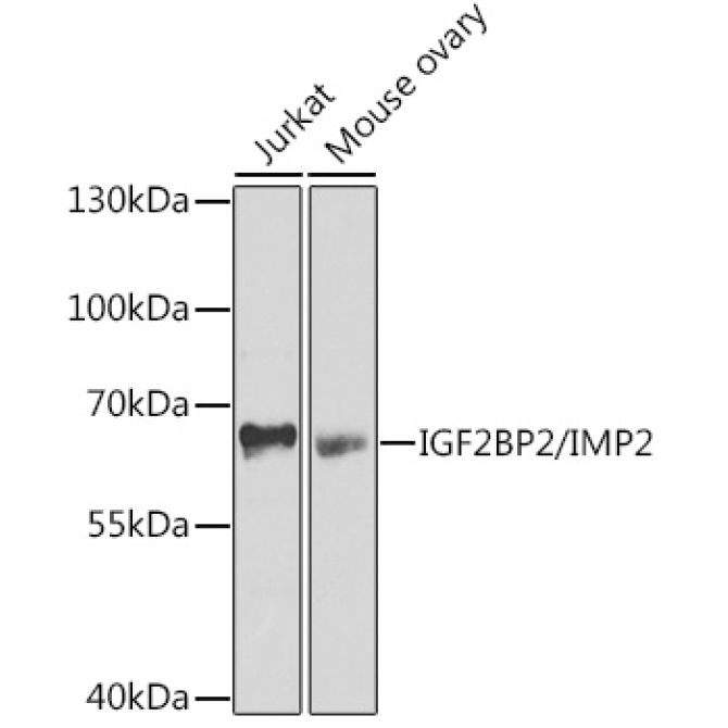 IGF2BP2/IMP2 Rabbit Polyclonal Antibody