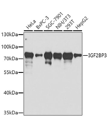 IGF2BP3 Rabbit Polyclonal Antibody