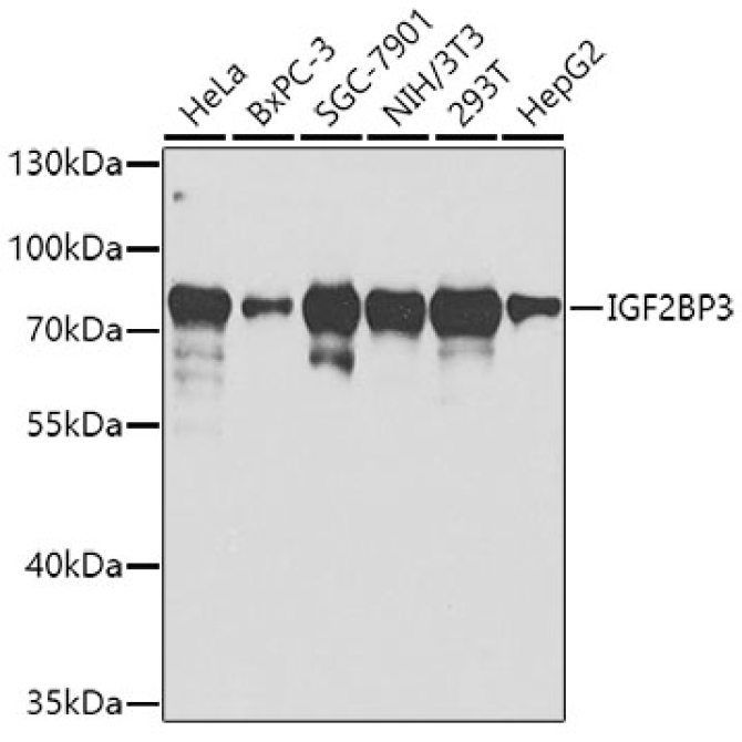 IGF2BP3 Rabbit Polyclonal Antibody
