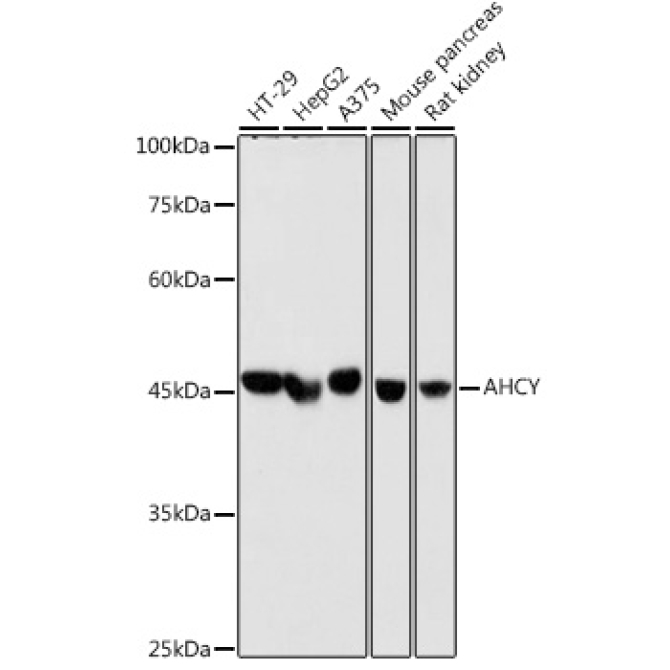 AHCY Rabbit Monoclonal Antibody