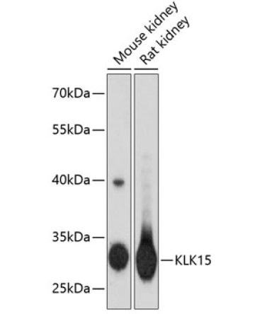 KLK15 Rabbit Polyclonal Antibody