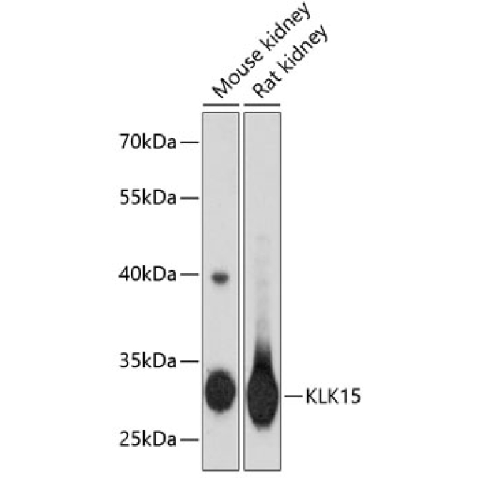 KLK15 Rabbit Polyclonal Antibody
