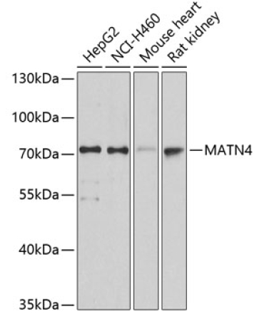 MATN4 Rabbit Polyclonal Antibody