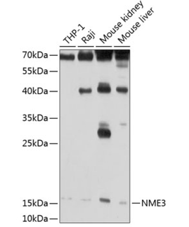 NME3 Rabbit Polyclonal Antibody