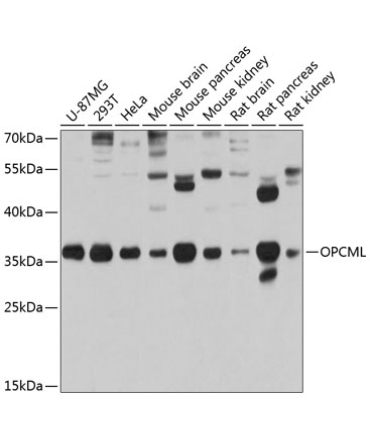OPCML Rabbit Polyclonal Antibody