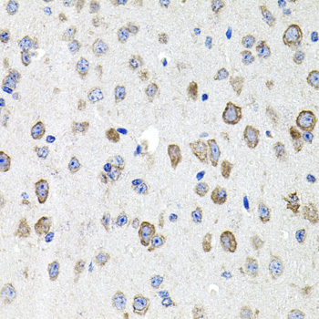 CDH23 Rabbit Polyclonal Antibody