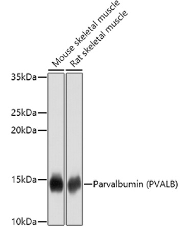 Parvalbumin/PVALB Rabbit Polyclonal Antibody