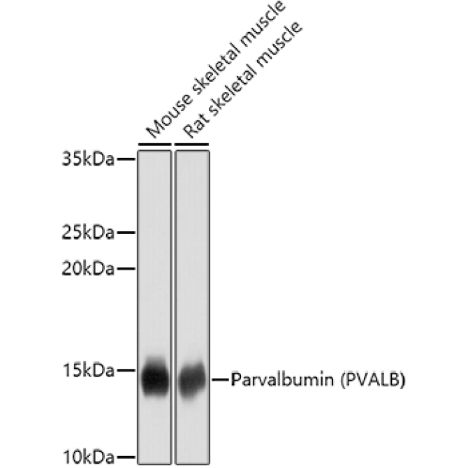 Parvalbumin/PVALB Rabbit Polyclonal Antibody