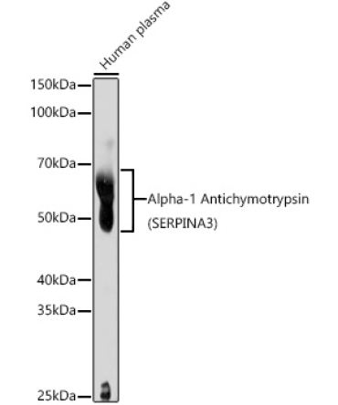 Alpha-1 Antichymotrypsin (SERPINA3) Rabbit Polyclonal Antibody