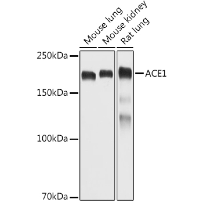 ACE1 Rabbit Polyclonal Antibody