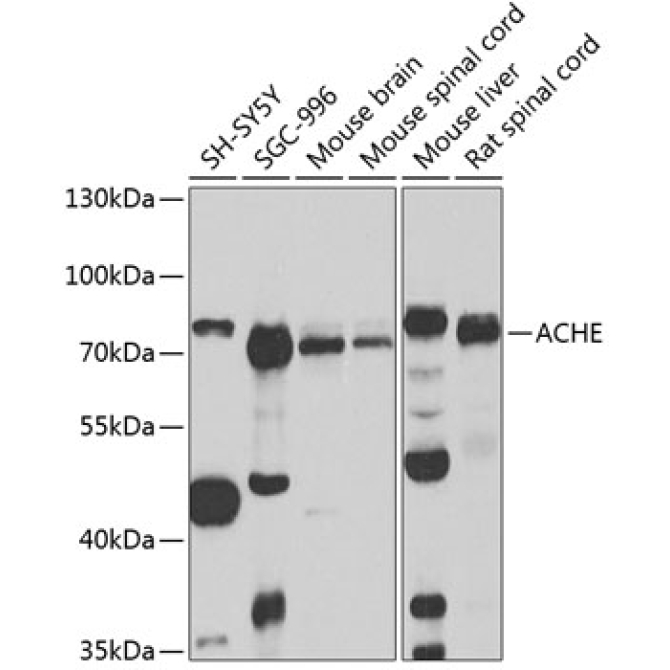 ACHE Rabbit Polyclonal Antibody