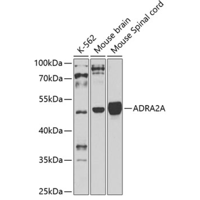 ADRA2A Rabbit Polyclonal Antibody