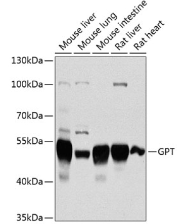GPT Rabbit Polyclonal Antibody