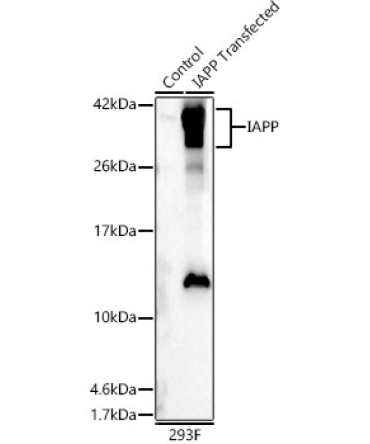 IAPP Rabbit Polyclonal Antibody