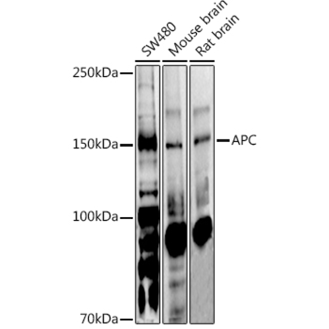 APC Rabbit Polyclonal Antibody
