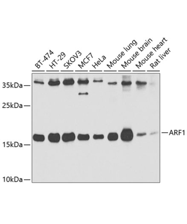 ARF1 Rabbit Polyclonal Antibody