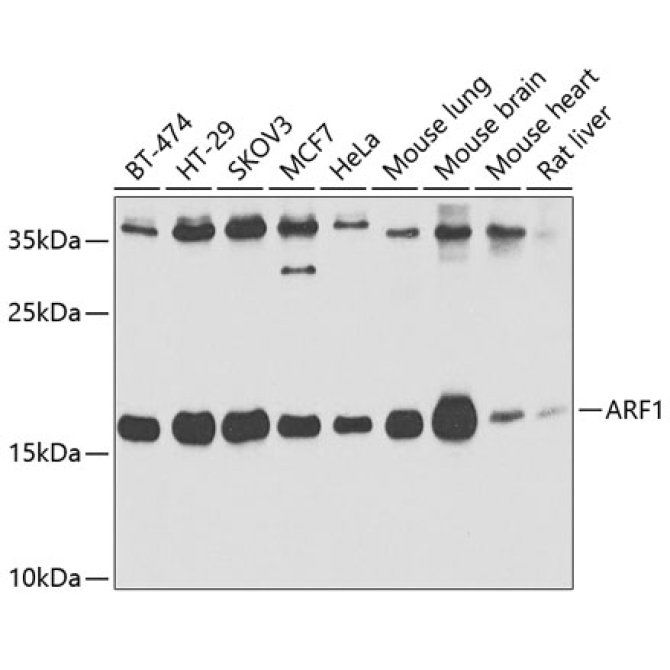 ARF1 Rabbit Polyclonal Antibody