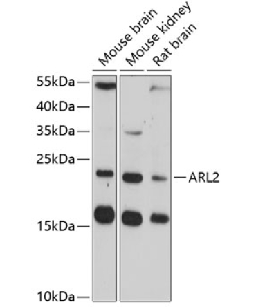 ARL2 Rabbit Polyclonal Antibody