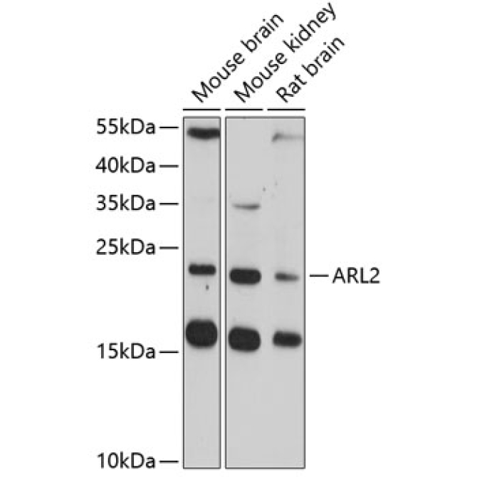 ARL2 Rabbit Polyclonal Antibody