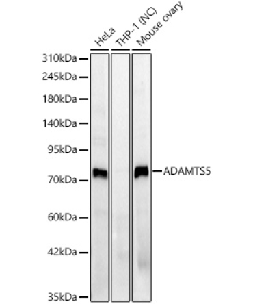 ADAMTS5 Rabbit Polyclonal Antibody