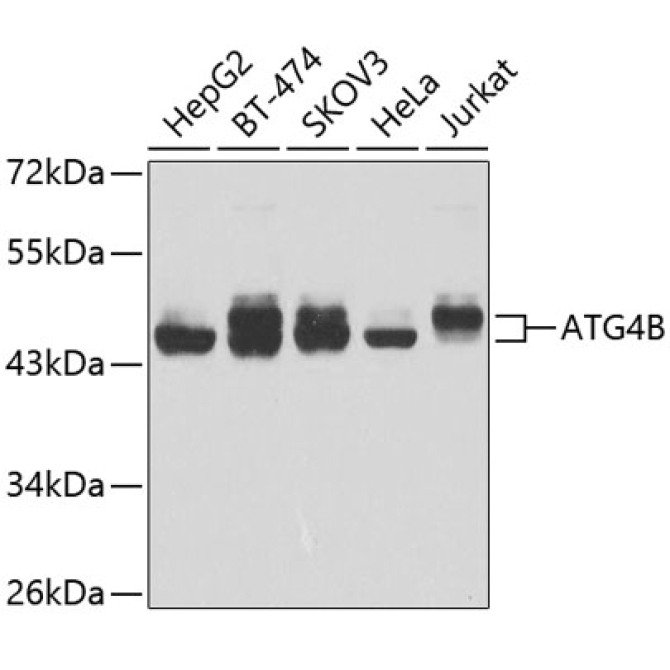 ATG4B Rabbit Polyclonal Antibody