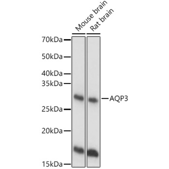 AQP3 Rabbit Polyclonal Antibody