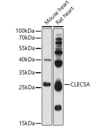CLEC5A Rabbit Polyclonal Antibody
