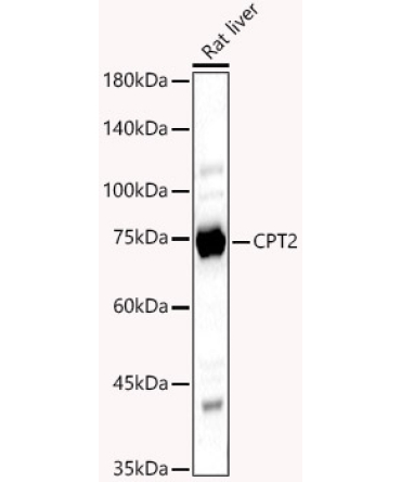 CPT2 Rabbit Polyclonal Antibody