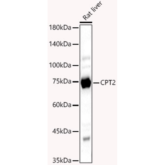 CPT2 Rabbit Polyclonal Antibody