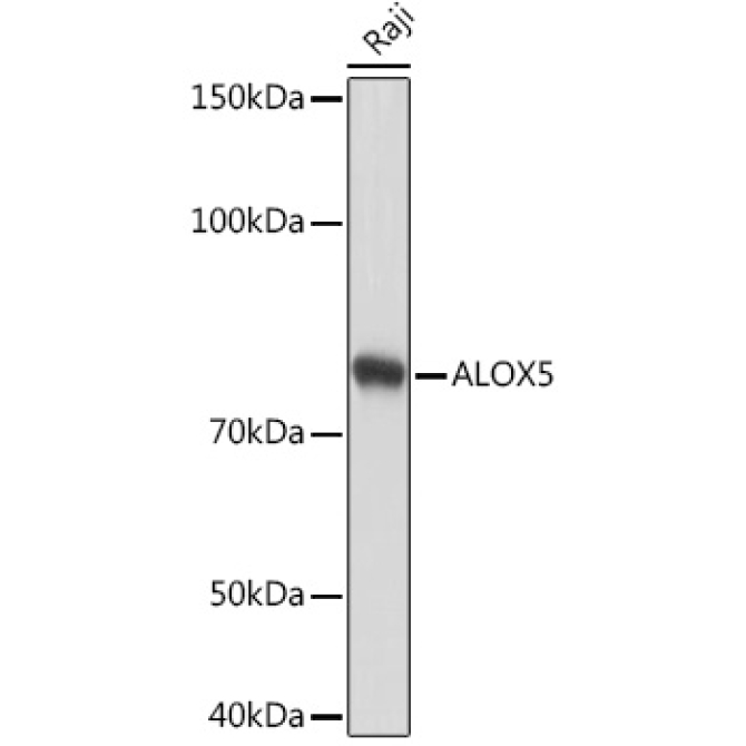 ALOX5 Rabbit Monoclonal Antibody