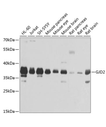 GJD2 Rabbit Polyclonal Antibody