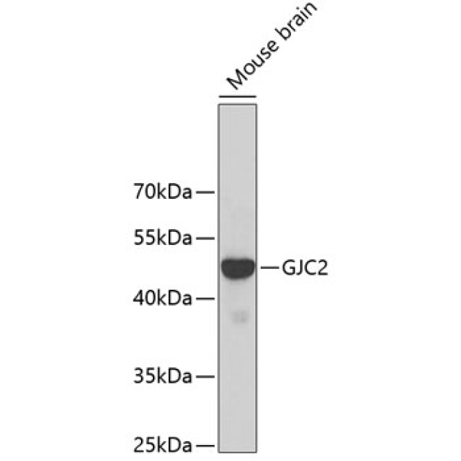 GJC2 Rabbit Polyclonal Antibody