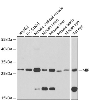 MIP Rabbit Polyclonal Antibody
