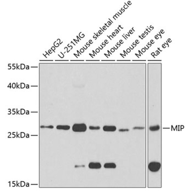 MIP Rabbit Polyclonal Antibody